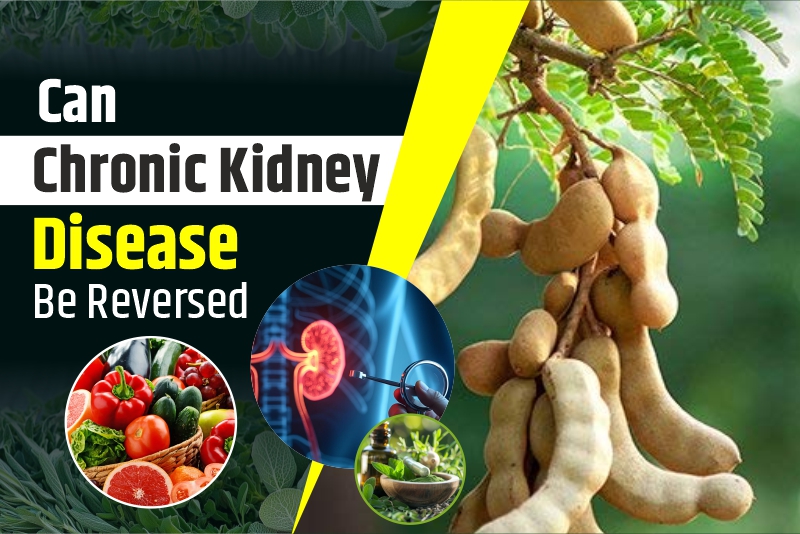 Can Chronic Kidney Disease Be Reversed